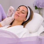 microneedling downtime